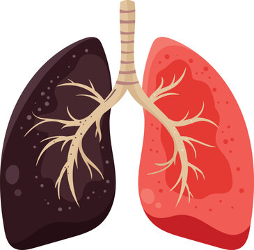 Dark Damaged Lung and Healthy Lung Respiratory Health Concept