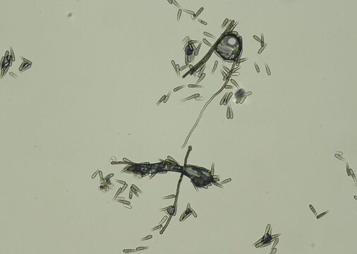 soil microorganisms under a microscope including amoeba, flagellates, nematodes, fungi, bacteria	