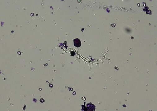 soil microorganisms under a microscope including amoeba, flagellates, nematodes, fungi, bacteria	