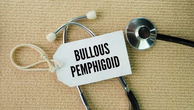 Stethoscope and paper tag with the word Bullous pemphigoid. chronic autoimmune skin condition that causes large, fluid-filled blisters to form on the skin