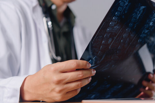 Doctor Reviewing Medical X Ray Film for Diagnosis