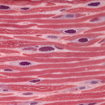 Highly  light microscopy photograph of human skeletal muscle in longitudinal section