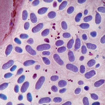 light microscopy photograph of microglia in brain tissue

