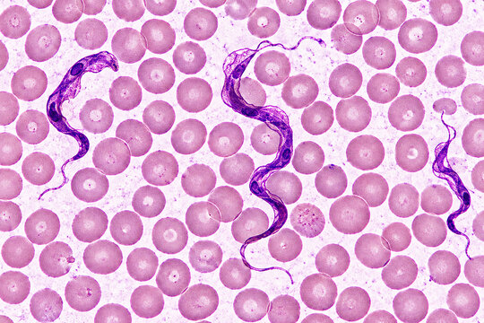 Light micrograph of a blood smear showing Trypanosoma parasites