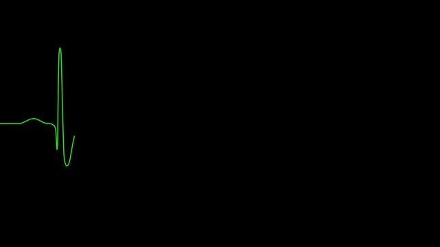 Green EKG heartbeat line animation on a clean black background, symbolizing heart rate, cardiac monitoring, medical health, diagnosis, and healthcare technology.