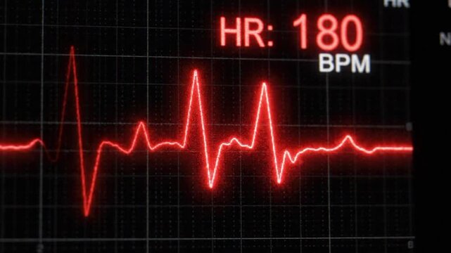 Heartbeat flatline electrocardiogram shows critical medical condition