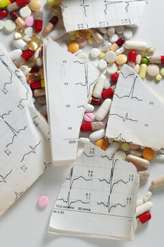 Scattered Pills and Torn ECG