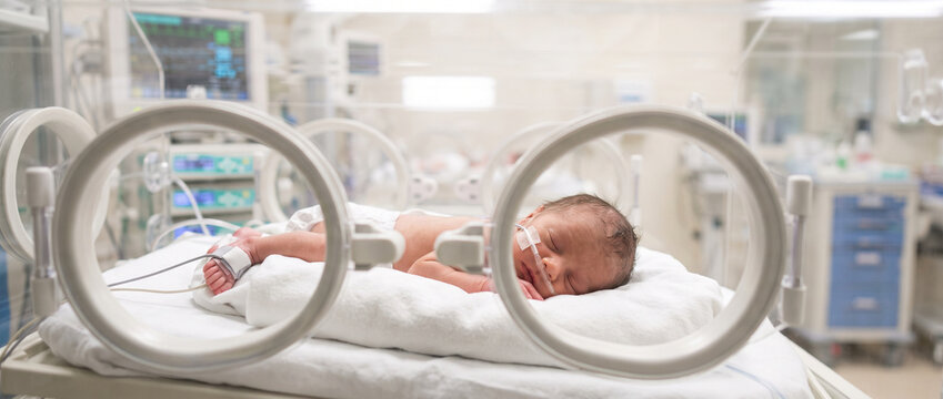 Premature newborn baby girl resting peacefully, representing neonatal care, early birth, infant health, medical support and the delicate first days of life.