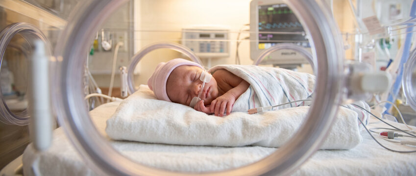 Premature newborn baby girl resting peacefully, representing neonatal care, early birth, infant health, medical support and the delicate first days of life.