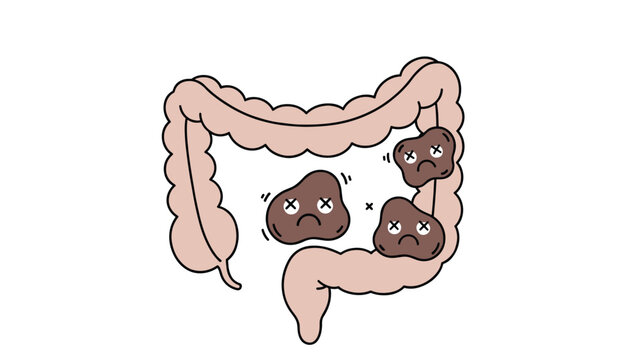 An educational illustration of human intestines with cartoon bad bacteria or stool lumps causing digestive issues.