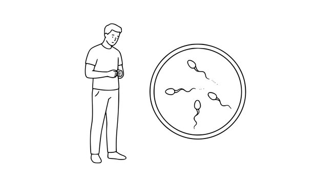 Reduced Sperm Motility Male Infertility Concept Vector Art