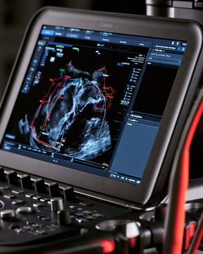 Ultrasound machine using real-time machine learning technology