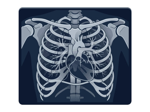 Human chest xray flat vector illustration for medical diagnostics and anatomy education concept on dark background