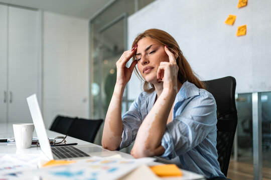 Business woman with headache rubbing temples at desk. Tired female professional feeling stress, burnout in office. Exhausted manager working on laptop with documents, financial reports, and coffee.