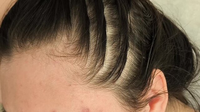 a woman examining thin, sparse hair at the roots, representing hair thinning, low hair density and concerns about hair quality.