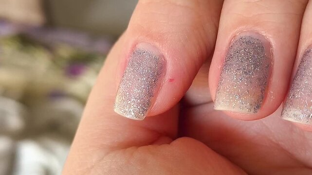 a finger with a small wound caused by a hangnail, illustrating damaged skin around the nail, nail biting consequences and minor hand injuries.