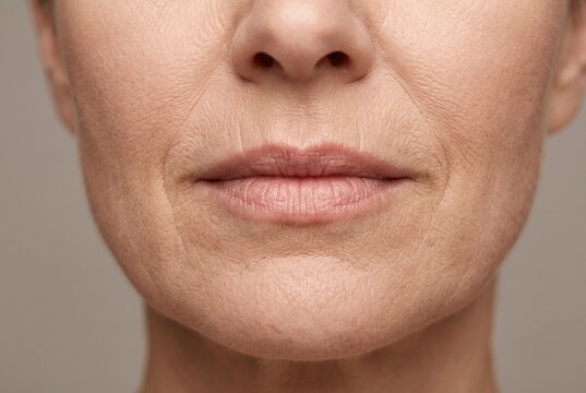 Macro close up of natural perioral fine lines and lip texture on mature adult skin for dermatology and skincare education