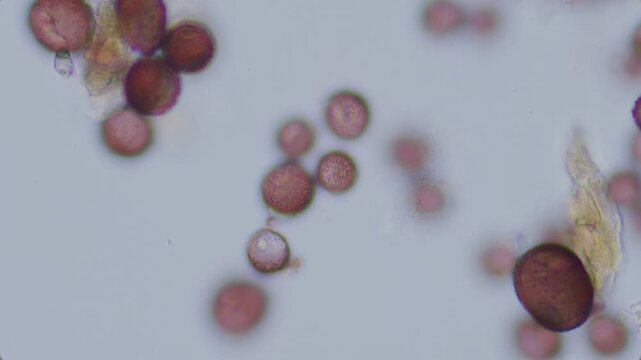 Lime mold spores with visible surface texture in KOH solution under microscope 100x objective, oil immersion