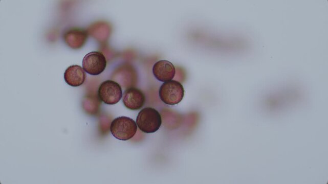 Lime mold spores with visible surface texture in KOH solution under microscope 100x objective, oil immersion