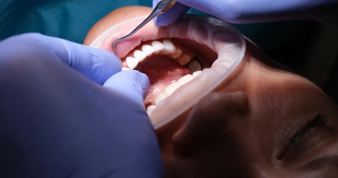 Dentist applies thin custom-made veneers to teeth of patient. Dental specialist creates polished and natural-looking smile in dental clinic