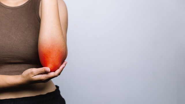 Woman Holding Painful Elbow Joint Tennis Elbow Concept