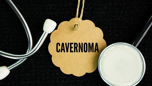Stethoscope and paper tag with the word cavernoma also called a cavernous malformation is a cluster of abnormal, thin-walled, blood-filled vessels shaped like a raspberry that most commonly occurs 