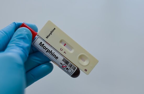 Blood sample tube of patient negative result for morphine.