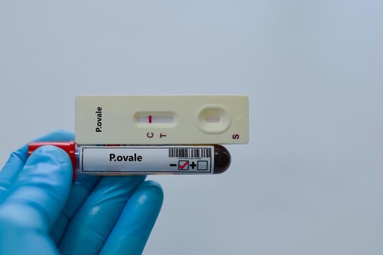 Blood sample tube of patient negative result for P.ovale