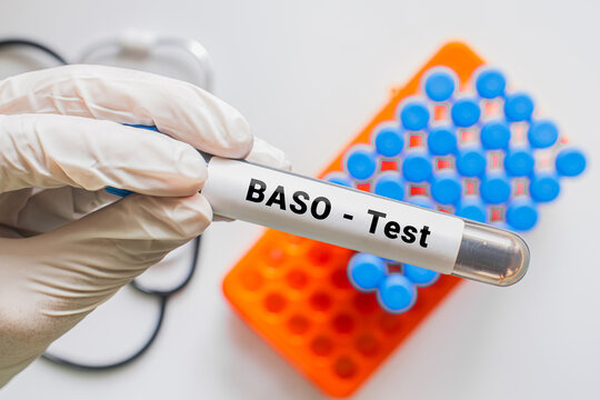 Gloved hand holding BASO test blood tube with laboratory rack