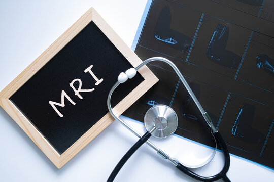MRI text on black chalkboard with stethoscope on dark background, medical imaging and diagnostic concept