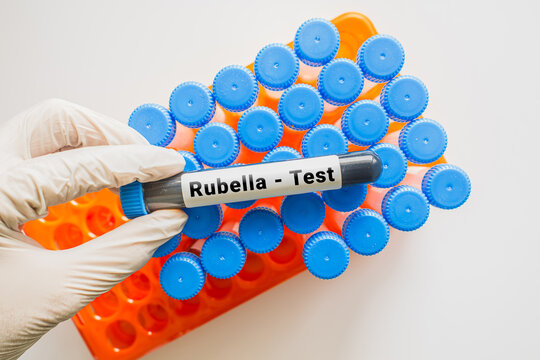 Gloved hand holding Rubella test blood tube with laboratory rack