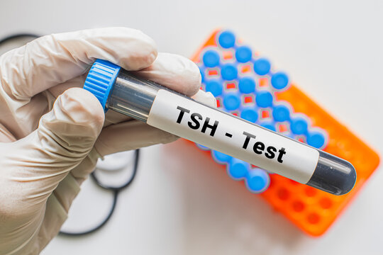 Gloved hand holding TSH test blood tube with laboratory rack