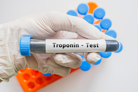 Gloved hand holding Troponin test blood tube with laboratory rack