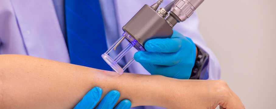 Laser Machine.Young woman receiving laser treatment.Skin Care.Young Woman Receiving Facial Beauty Treatment, Removing Pigmentation At Cosmetic Clinic.IPL. Photo Facial Therapy.Anti-aging Procedures.