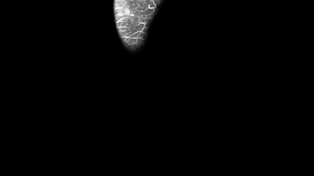 Coronal T2-Weighted MRI Scan of Human Foot and Sole Anatomy