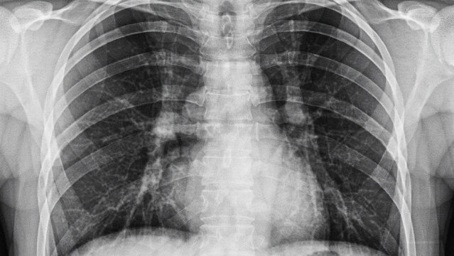Medical professional examining a chest X-ray in a clinical setting with copy space