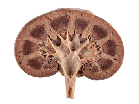 Human Kidney Cutaway Showing Internal Renal Anatomy and Structures