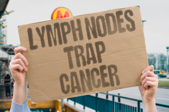 "Lymph nodes trap cancer" Filtering stations contain spreading malignant cells. LYMPH. NODES. METASTASIS. FILTERING. CONTAINMENT.