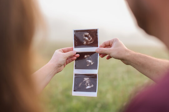 Pregnant Couple Looking at Ultrasound Photos With Shallow Depth of Field