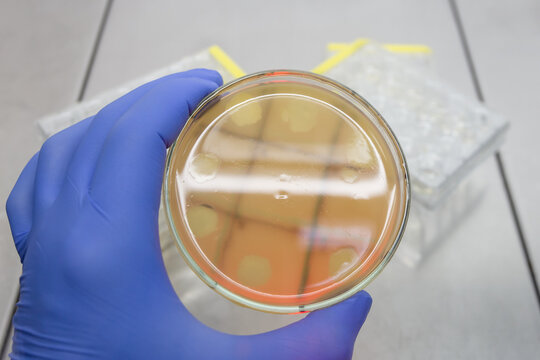 Close-up of a scientist holding a Petri dish with marked sectors against the background of a laboratory workbench.
