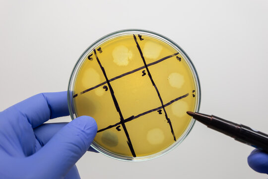 A close-up shot shows a scientist using a felt-tip pen to point out zones of bacterial lysis caused by a virus on a Petri dish. Method for analyzing the effect of a bacteriophage on E. coli.