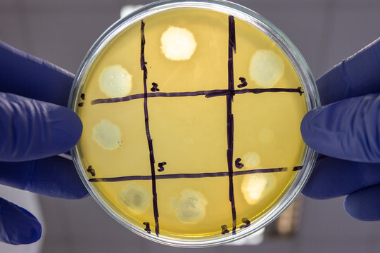 A scientist holding a Petri dish showing zones of bacterial culture lysis caused by bacteriophage action.