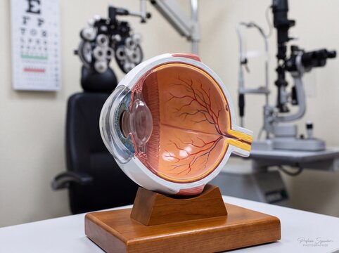 Anatomical human eye model in an ophthalmology clinic