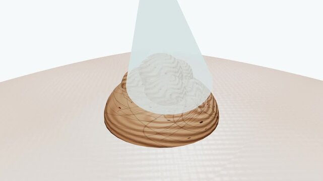 3D medical animation of cryosurgery process using liquid nitrogen to freeze and destroy skin lesion, showing cellular ice crystal formation, tissue necrosis, desquamation, and healthy regeneration