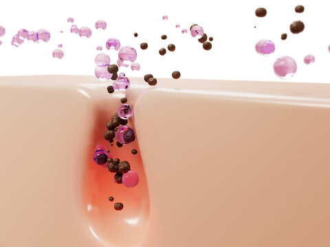 3d cleansing clogged pores with pink gel bubbles. Face cleanser, rose water toner or lotion drops, liquid cosmetic spheres for skin care. Acne treatment, remove blackheads, ad banner
