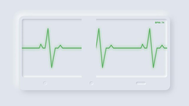 Digital ECG Heart Rate Monitoring Dashboard Animation with Green Electrocardiogram Waveform, Patient Vital Sign Tracking Interface, Cardiology Healthcare Technology and Modern Medical System Backgroun