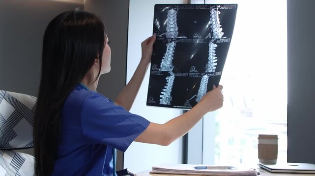 Asian female surgeon in blue scrubs checking x-ray film of patient in clinic for orthopedic diagnosis and medical healthcare services. Young woman doctor examining bone MRI scan in a modern hospital.