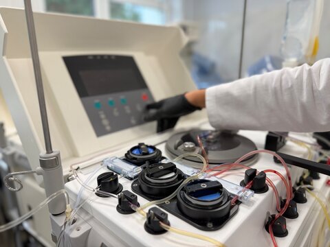 Apheresis Machine Doing Blood Component Separation in Medical Laboratory
