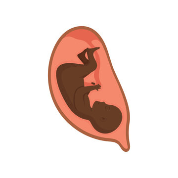Black fetus in cephalic presentation inside uterus medical pregnancy illustration