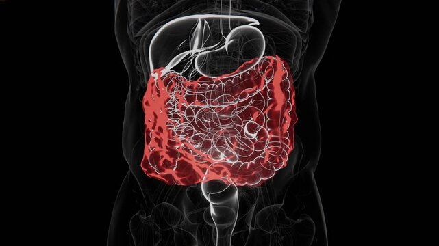 Abdominal adhesions are bands of scar tissue that can form between abdominal tissues and organs, causing them to stick together and potentially affecting normal movement in 4K UHD